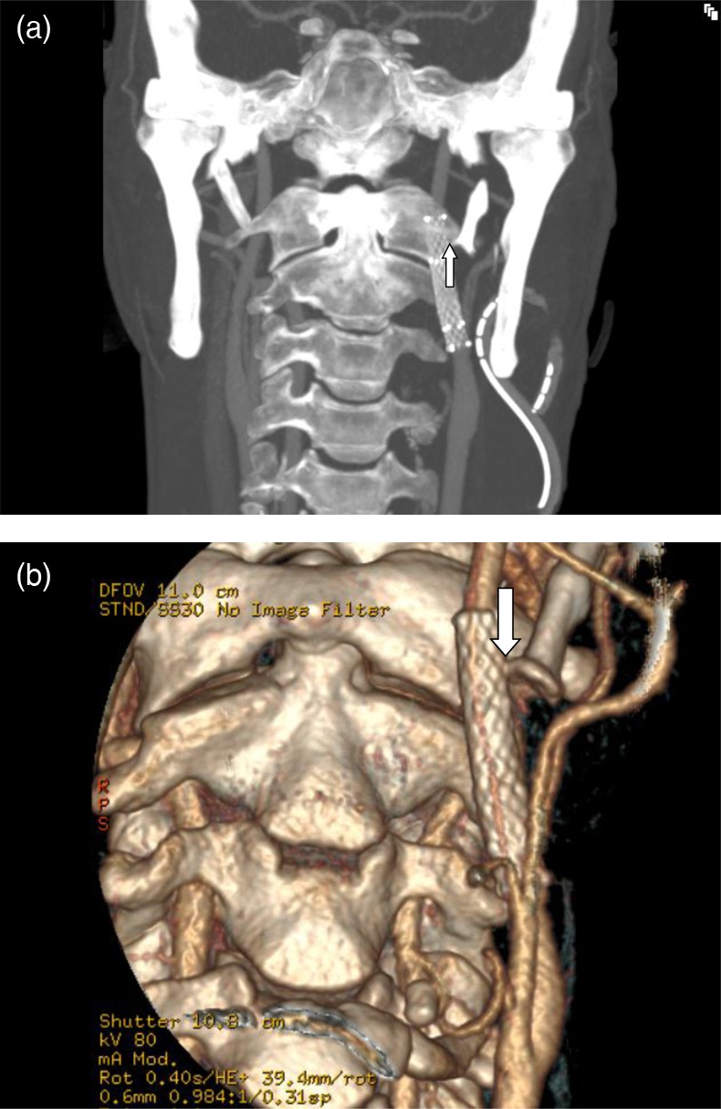 Figure 2