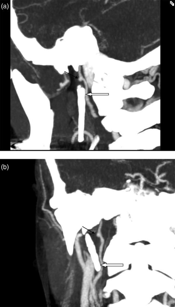 Figure 3