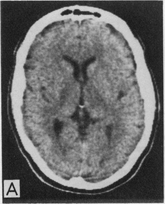 Figure 3. A