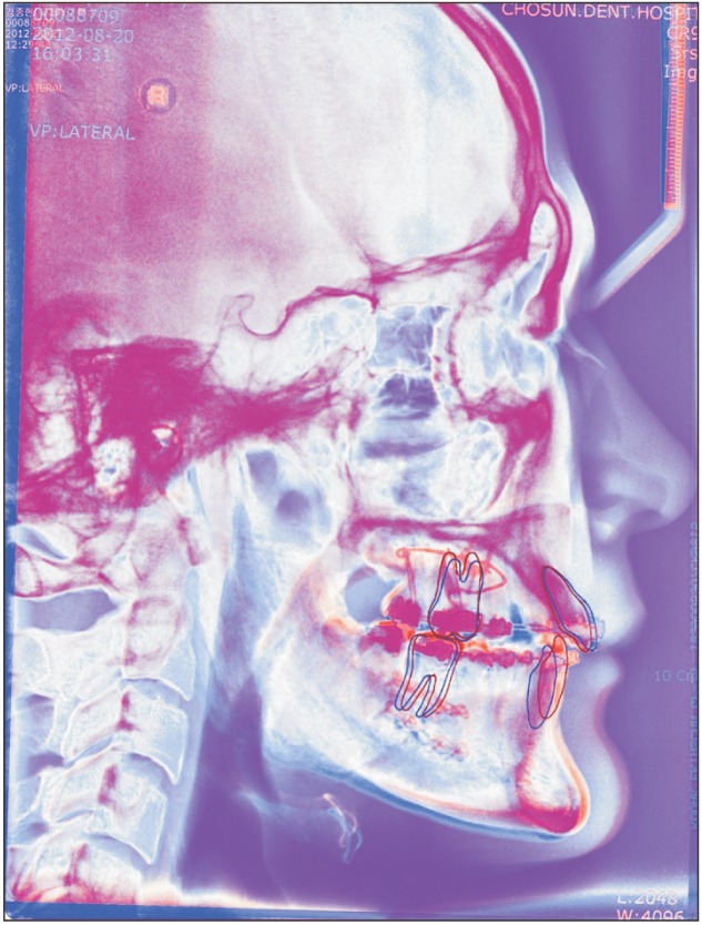 Fig. 2