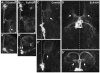 Fig. 12.