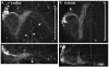 Fig. 11.
