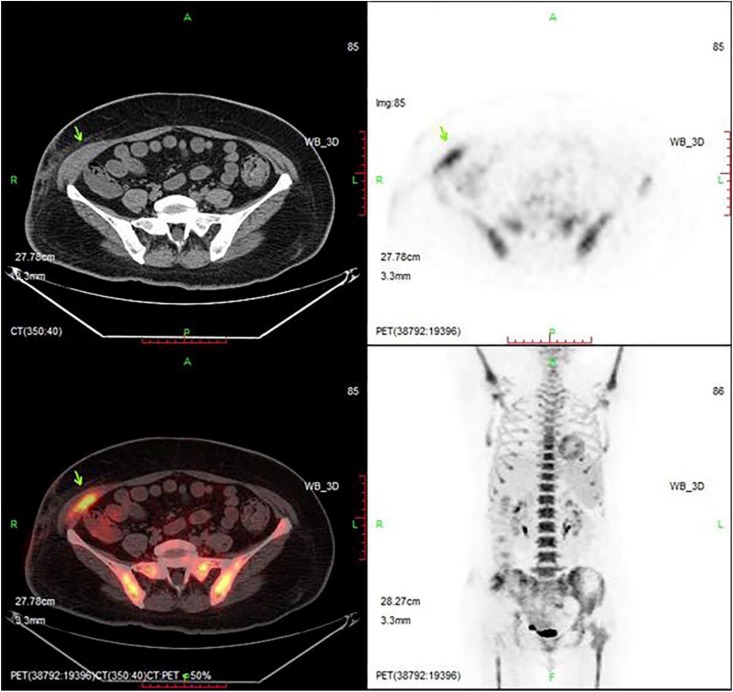 FIGURE 4