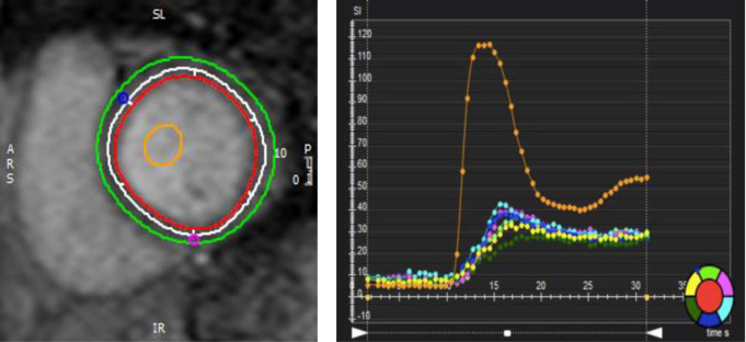 Fig 3