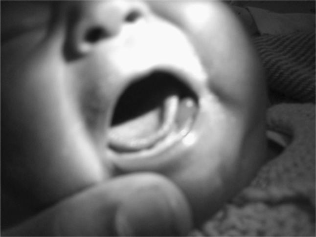 Fig. 1