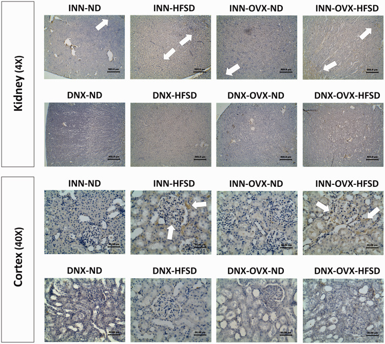 Figure 11.