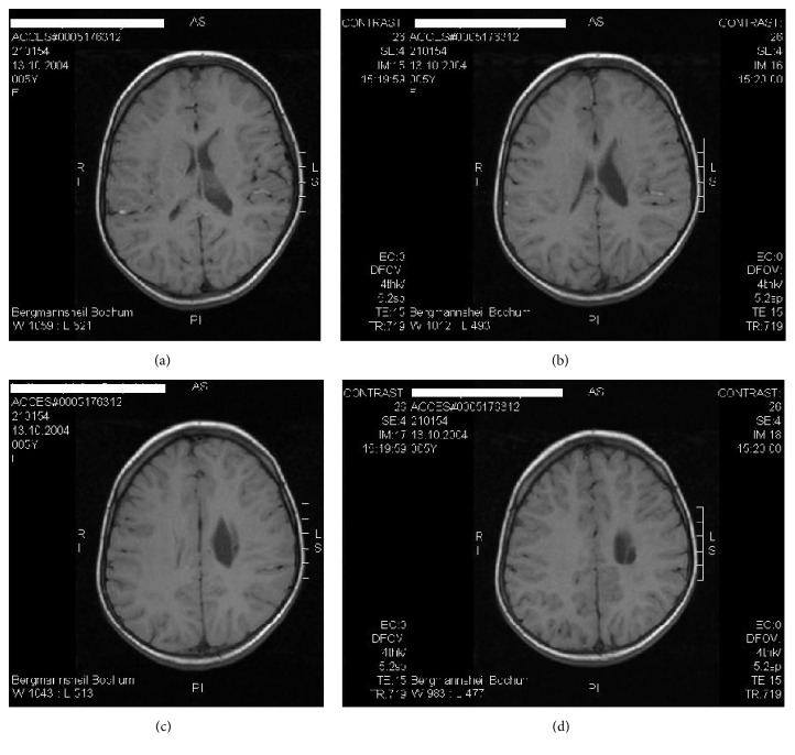 Figure 4