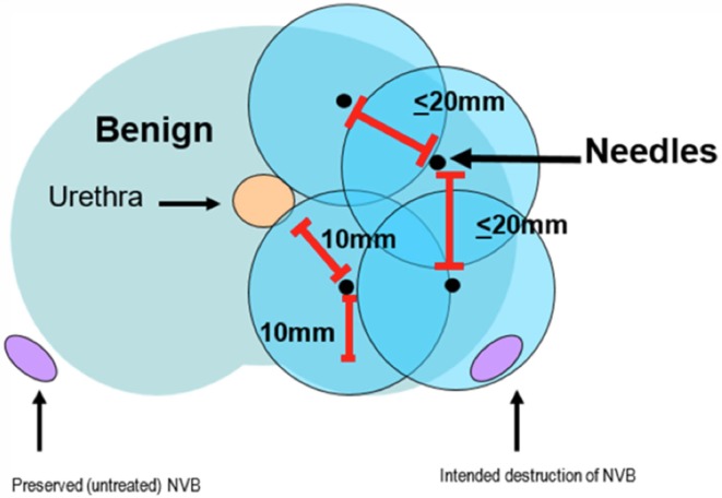 Fig. 3