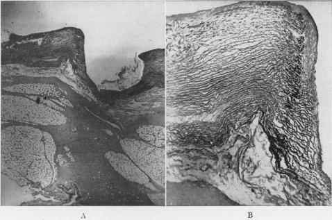 Fig. 3, A and B.