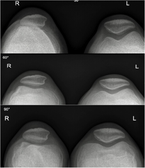 Fig. 3