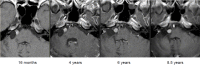 Figure 19