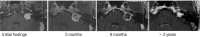 Figure 33