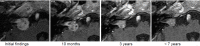 Figure 25