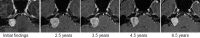 Figure 30