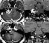 Figure 18
