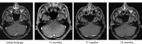 Figure 37