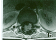 Figures 1 and 2
