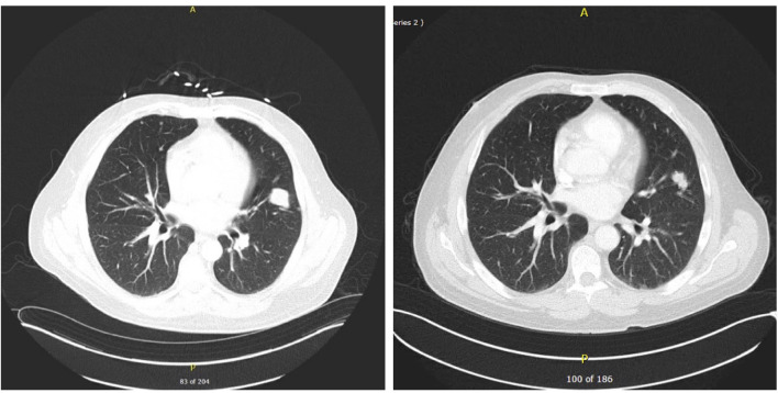 Figure 3