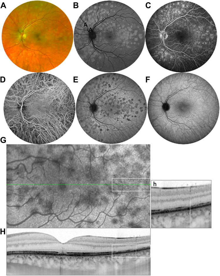 Figure 2