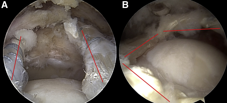 Fig 10