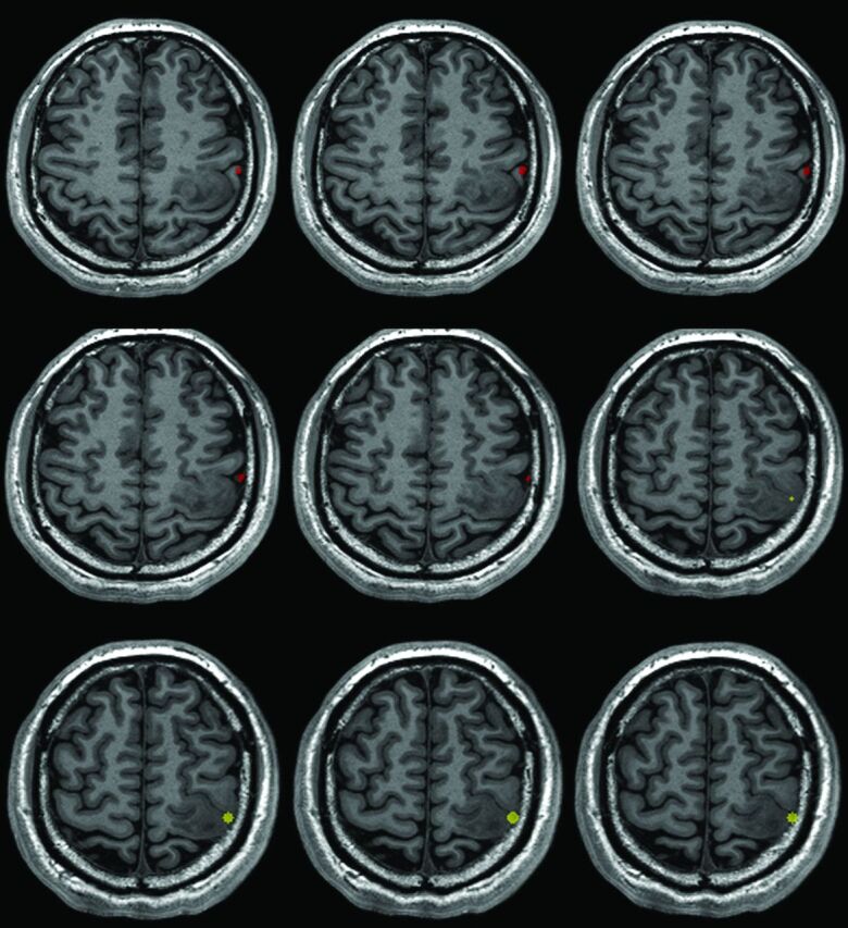 Fig 3.