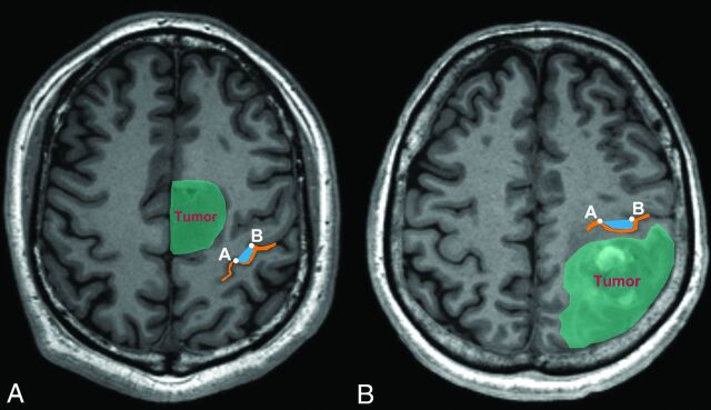 Fig 5.