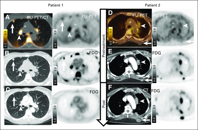 FIG 4.