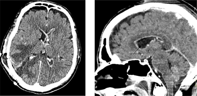 Fig. 7.