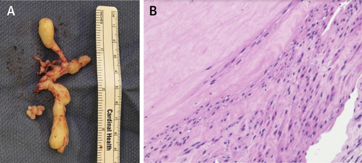 Figure 4