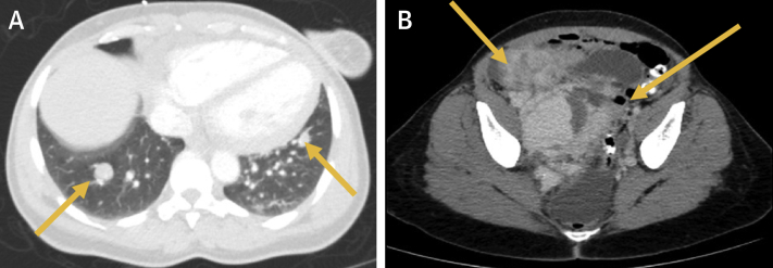 Figure 2