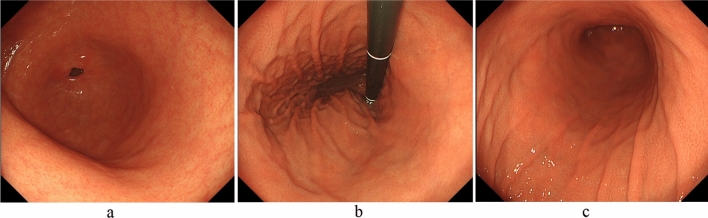 Fig. 4