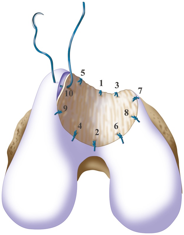 Fig. 9-A