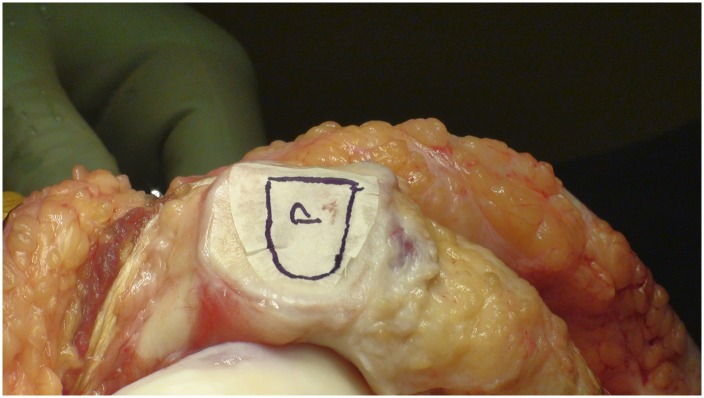 Fig. 8