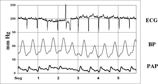 Fig 2.