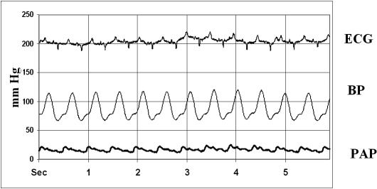 Fig 3.