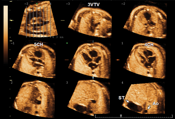 Figure 2.