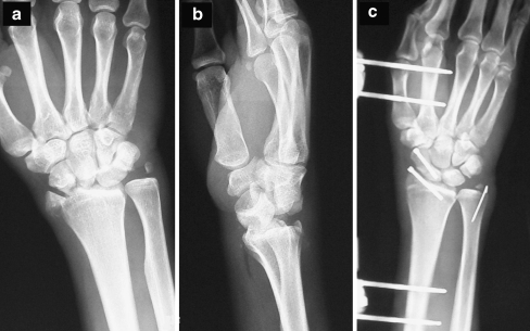 Fig. 1
