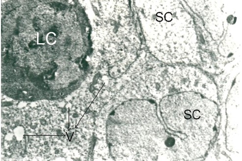 Figure 3c