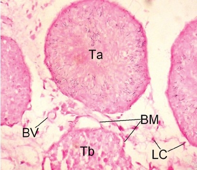 Figure 3d