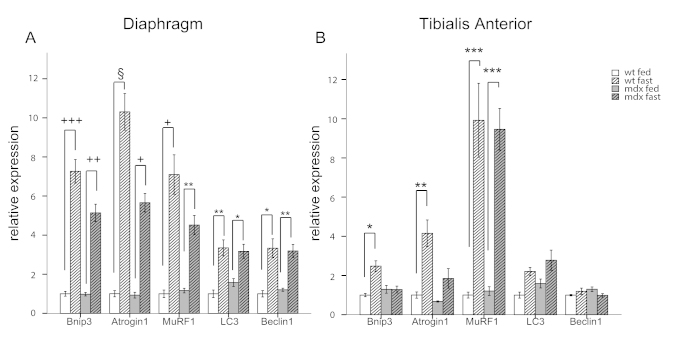 Autophagy impairment is mediated by FoxO3 transcription factor.