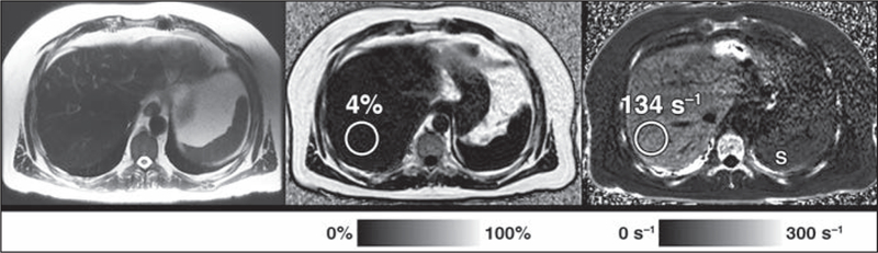 Fig. 2–