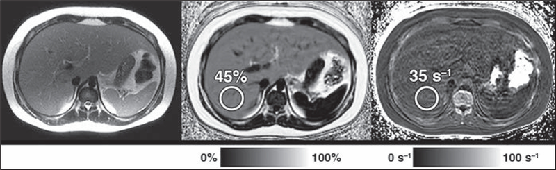 Fig. 1–