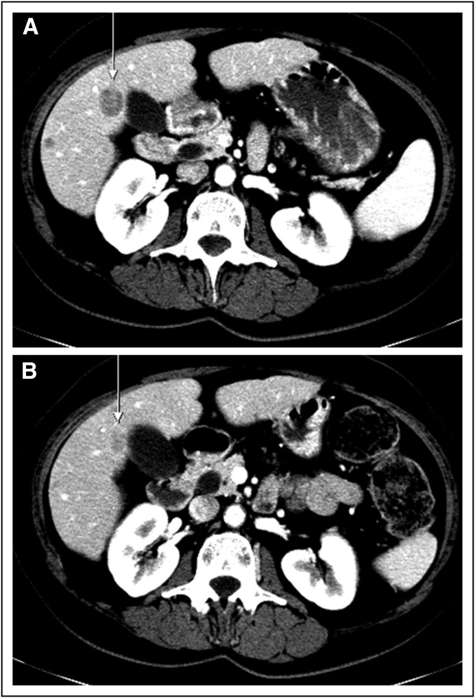 Fig 3.