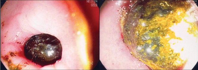 Figure 3)