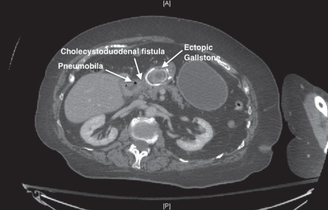 Figure 2)