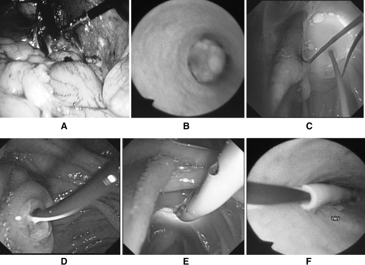 Fig. 1