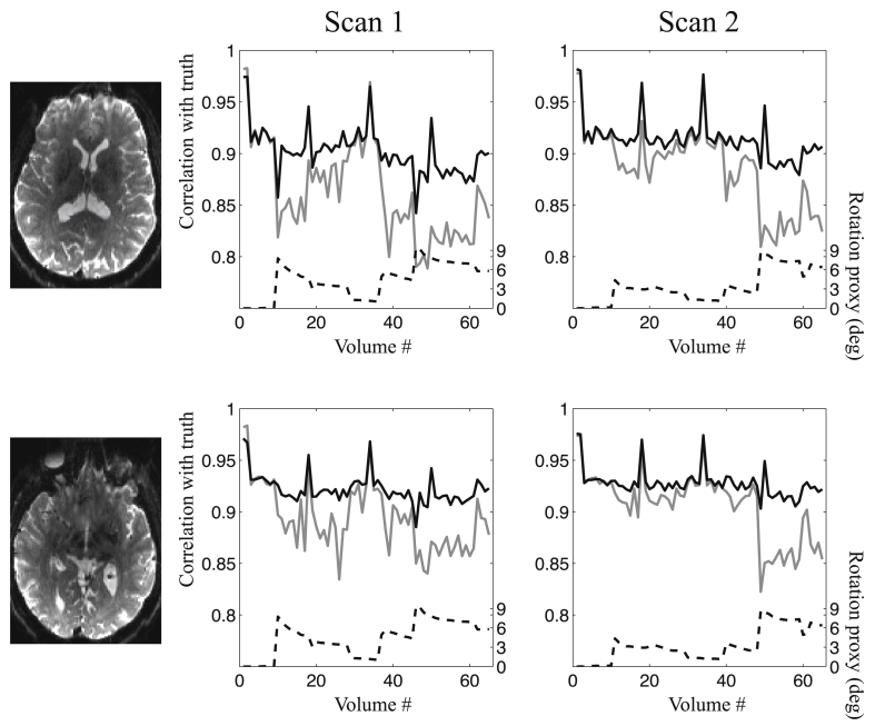 Fig. 11