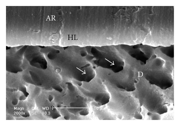 Figure 11