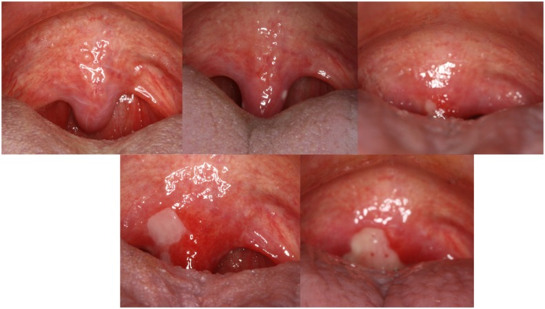 Fig 1