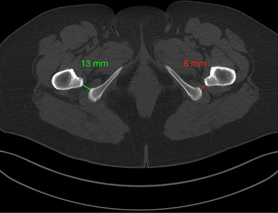 Fig. 2